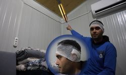 Yorgun merminin kafasına isabet etmesiyle kabusu yaşadı