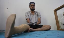 Kollarını ve bacağını kaybeden Ahmet ibadet ederek yaşama tutundu