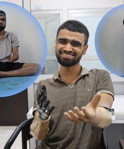 3 milyon TL değerindeki protez bacağına ve 2 biyonik koluna kavuştu