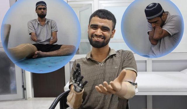 3 milyon TL değerindeki protez bacağına ve 2 biyonik koluna kavuştu